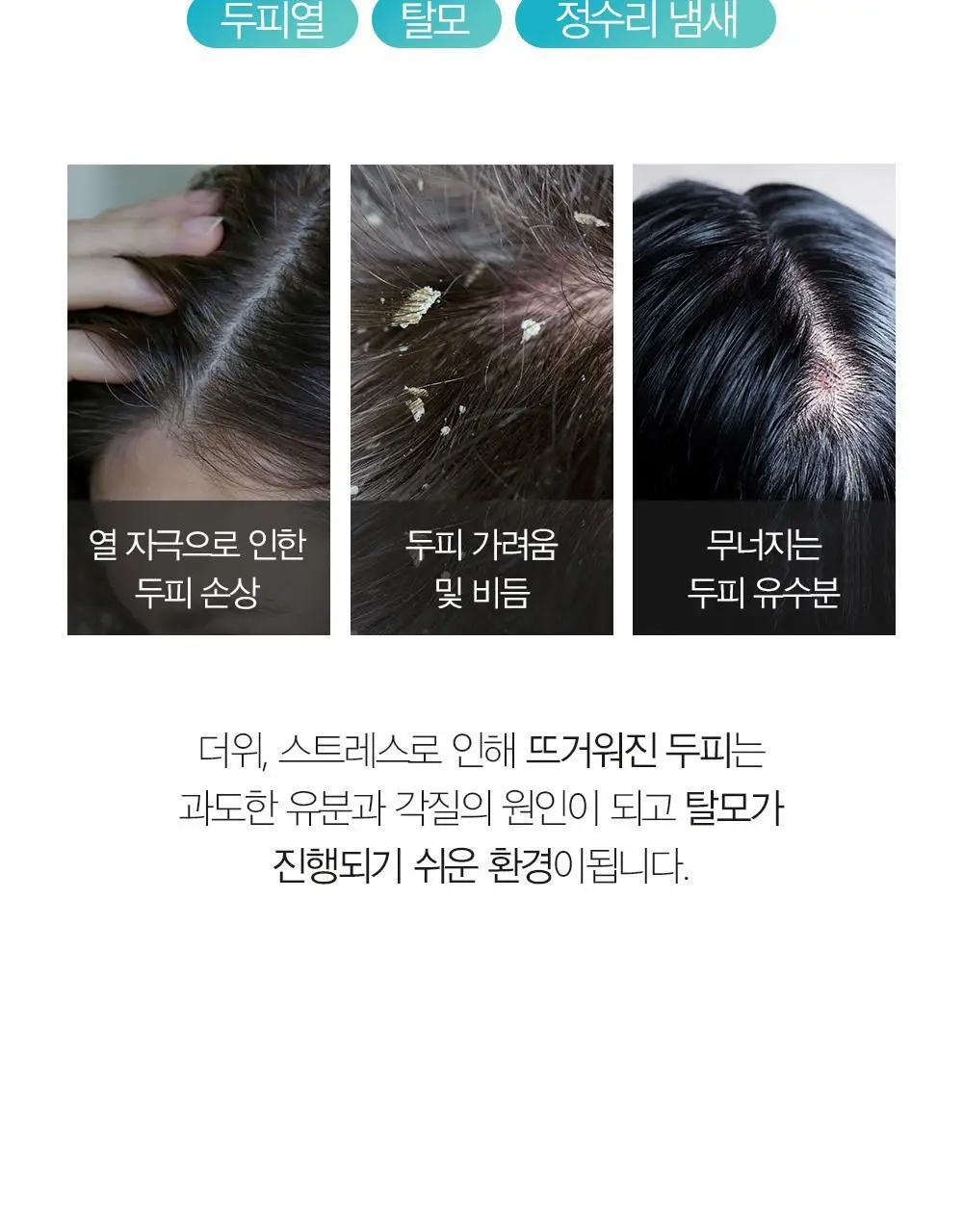 [탈모증상완화/두피열케어] 달리프 클로렐라 베러 루트 쿨링스프레이 100ml 상세페이지 3